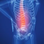 back pain relief Perth