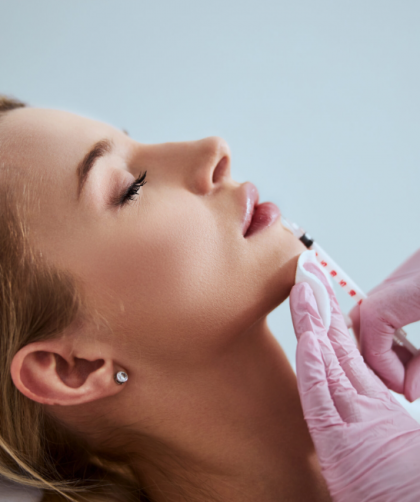 dermal fillers on the gold coast
