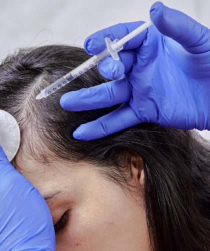 best hair loss treatment in NZ