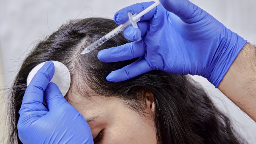 best hair loss treatment in NZ