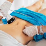Fat Reduction Treatments