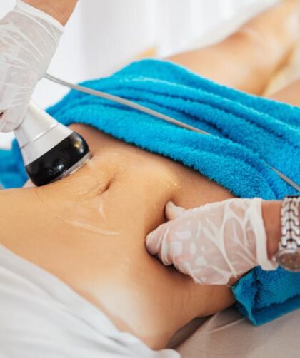 Fat Reduction Treatments