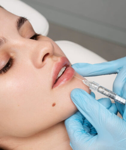 dermal fillers in Robina