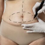 body sculpting clinic
