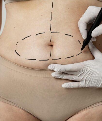 body sculpting clinic